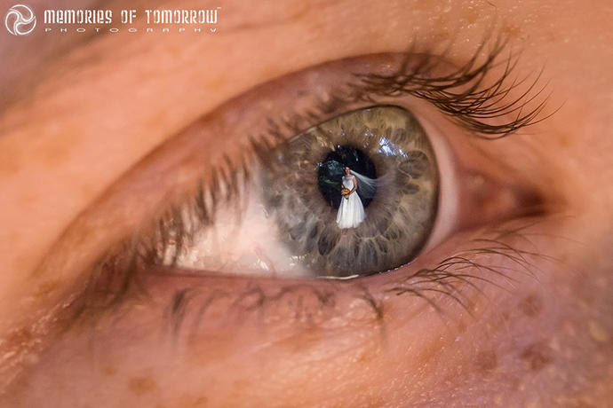 Gözdeki Yansımalarla Çekilen İnanılmaz Düğün Fotoğrafları