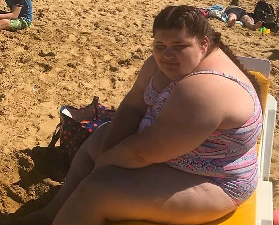 Sürekli Dalga Geçilen Bir Obezite Hastası: Paris Harvey
