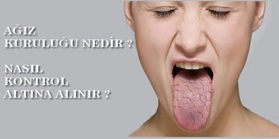 Çoğu Kişinin Dert Yandığı Bir Sorun: Ağız Kokusu!