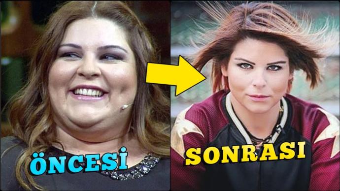 Kilo Verdikten Sonra Taş Gibi Olan 6 Ünlü!