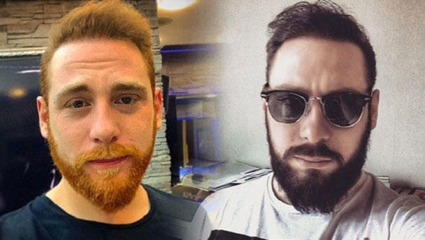 Koyu Renk Saçlarla Afet Olup Açık Renklerle "İdarelik" Olan 7 Yerli Ünlü!