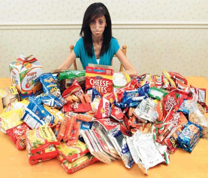 O Dünyanın En Çirkin ve En Öz Güvenli Kadını: Lizzie Velasquez