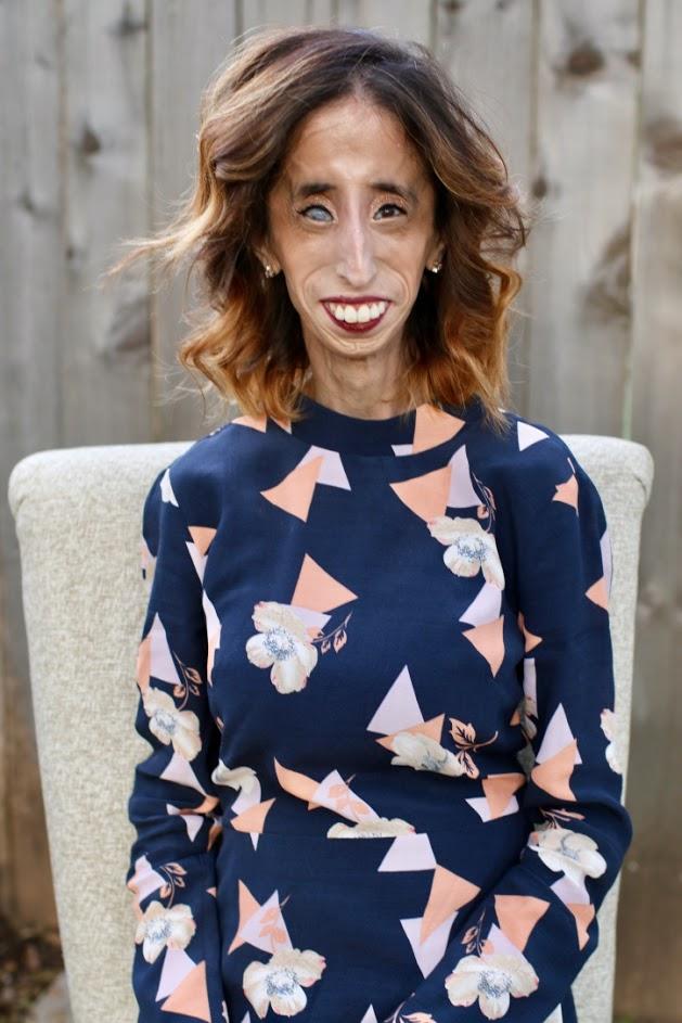 O Dünyanın En Çirkin ve En Öz Güvenli Kadını: Lizzie Velasquez