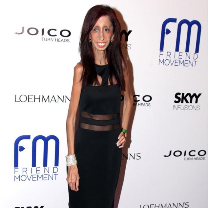 O Dünyanın En Çirkin ve En Öz Güvenli Kadını: Lizzie Velasquez