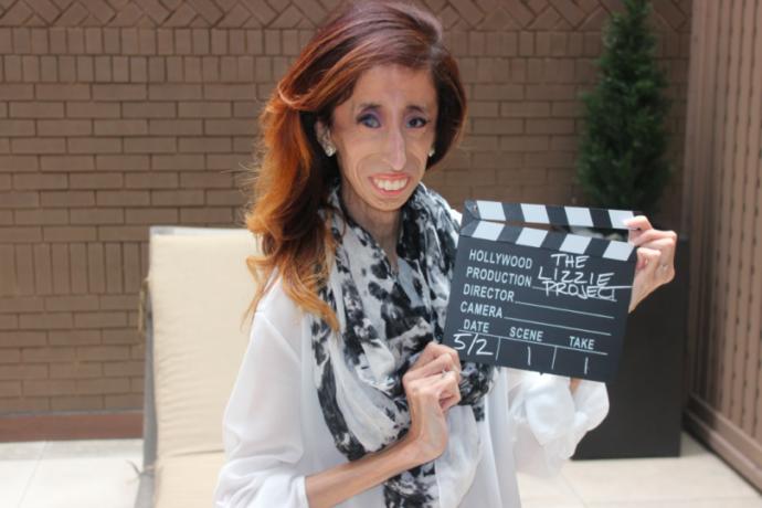 O Dünyanın En Çirkin ve En Öz Güvenli Kadını: Lizzie Velasquez