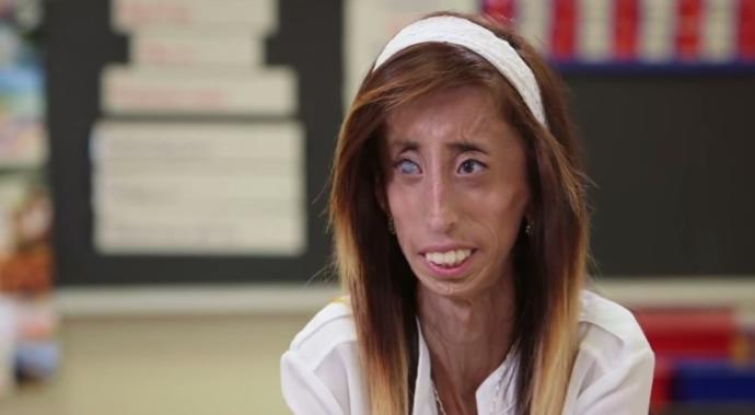 O Dünyanın En Çirkin ve En Öz Güvenli Kadını: Lizzie Velasquez