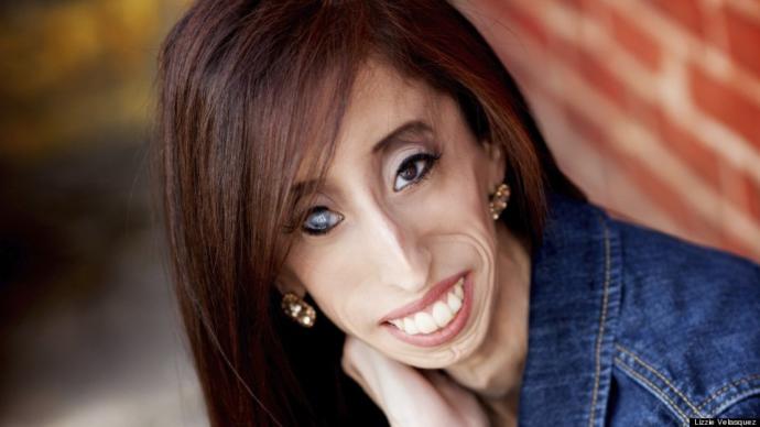 O Dünyanın En Çirkin ve En Öz Güvenli Kadını: Lizzie Velasquez