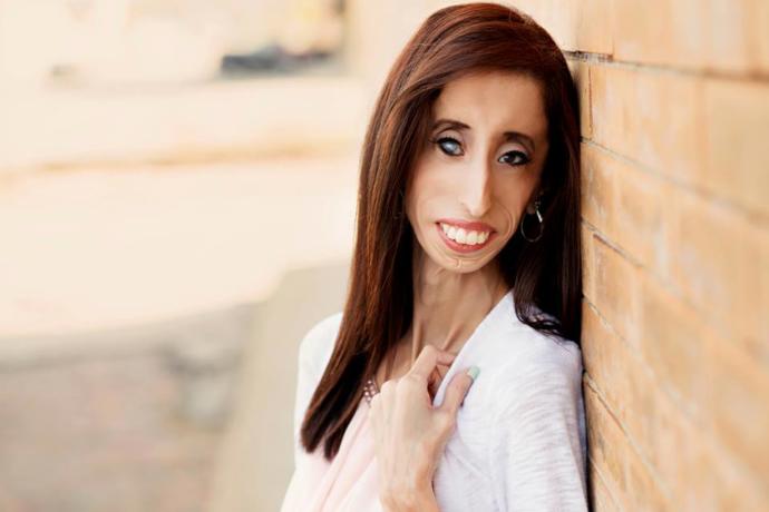 O Dünyanın En Çirkin ve En Öz Güvenli Kadını: Lizzie Velasquez