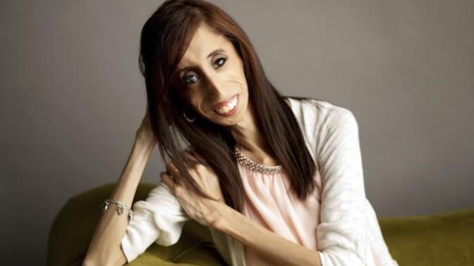 O Dünyanın En Çirkin ve En Öz Güvenli Kadını: Lizzie Velasquez