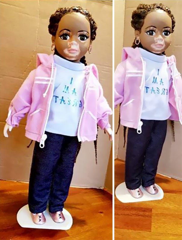 Nadir Cilt Hastalıklarına Dikkat Çekmek İsteyen Sanatçıdan Vitiligo Bebekler!