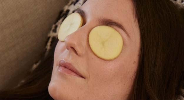 Göz Altı Morlukları ve Şişliklerine İyi Gelecek 6 Faydalı Bilgi!
