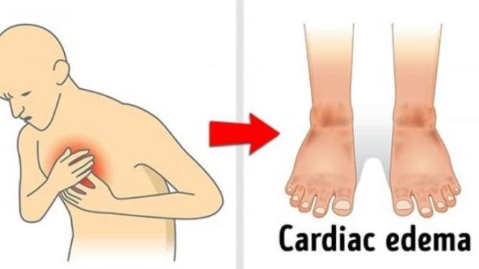 Sağlığınız İçin Vücudunuz Sizi Uyarıyor!