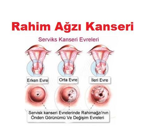 Erken Teşhis Hayat Kurtarır! HPV Virüsü Nedir?