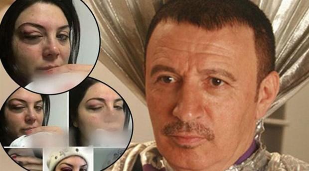 Yeni Tarzı İle "Bu Ne Hal Abi Ya?" Dedirten Bir Adam: Mustafa Topaloğlu