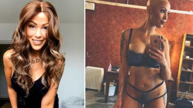 Asla Pes Etmemeyi ve Kendiyle Barışık Olmayı Bizlere Öğreten Bir Kadın: Therese Hansson!