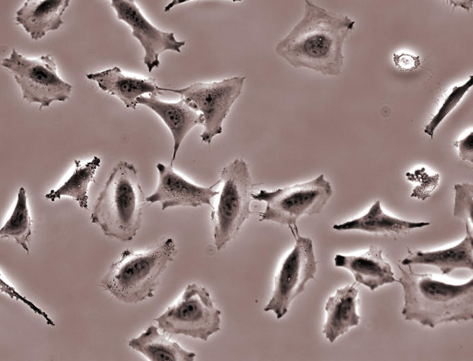 Henrietta Lacks’ın Ölümsüz Hayatı