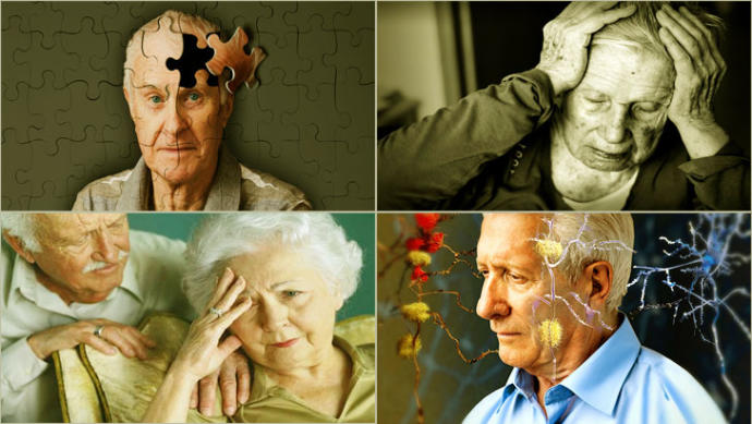 Alzheimer Hastaları ve Dövme Arasındaki Bağlantı