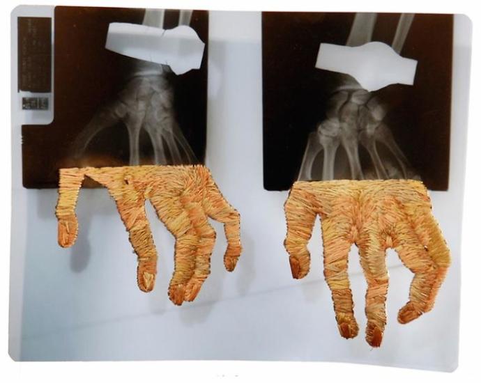 X-Ray Görüntülerine Sanatını İlmek İlmek İşleyen Sanatçı!