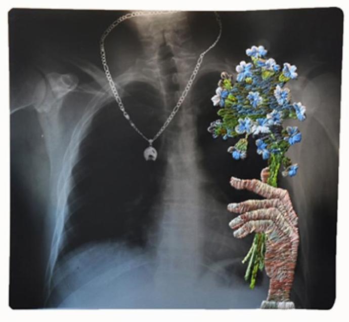 X-Ray Görüntülerine Sanatını İlmek İlmek İşleyen Sanatçı!