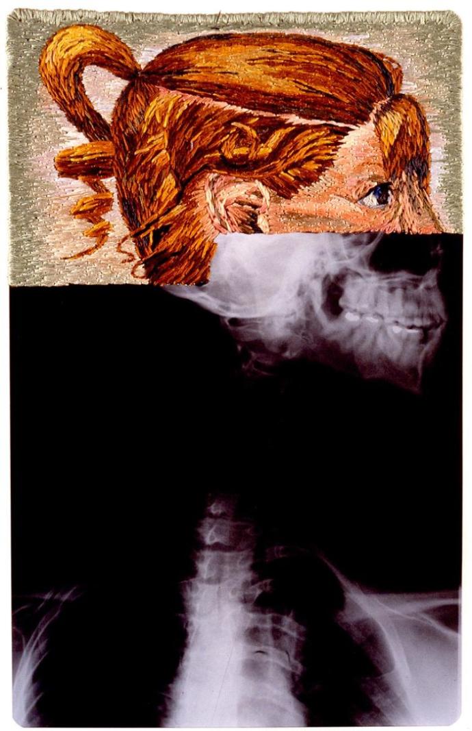 X-Ray Görüntülerine Sanatını İlmek İlmek İşleyen Sanatçı!