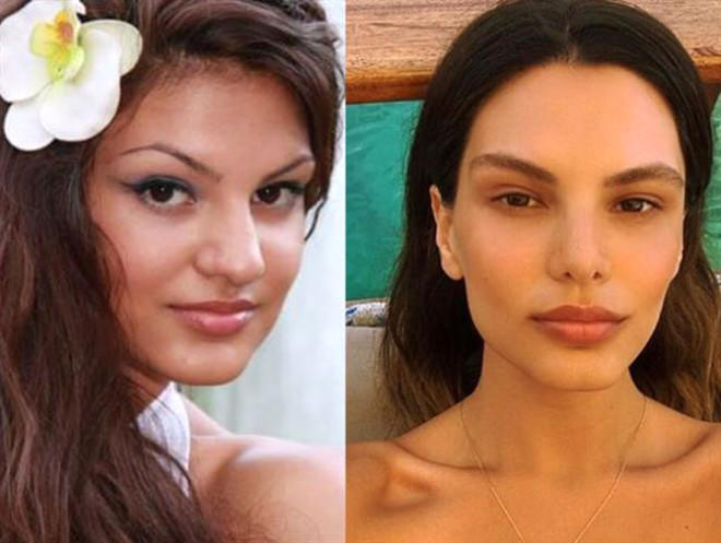 Estetiğin Anasını Ağlatan Ünlüler Hangileri?