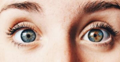 Van Kedisinin Insan Versiyonu Heterokromi Nedir Kizlarsoruyor