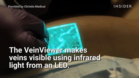 Delik Deşik Olmaktan Korkanlara Bilimsel Çözüm VeinViewer Nedir?