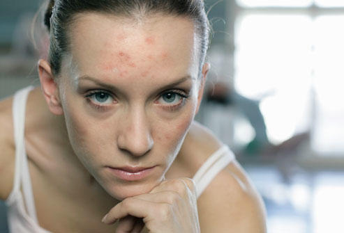 Hormonların Emrinde Kadınların Bir Ayı Nasıl Geçiyor?