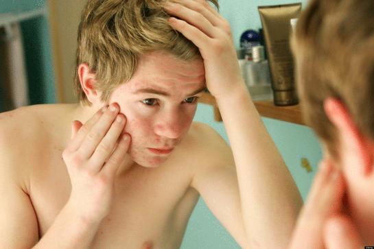 Erkeklere Özgü Hormonlar ve Erkeklerin Bilinmeyenleri Nelerdir?