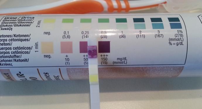 Ketojenik Diyetle, Aç Kalmak ve Kalori Saymak Tarih Oluyor!