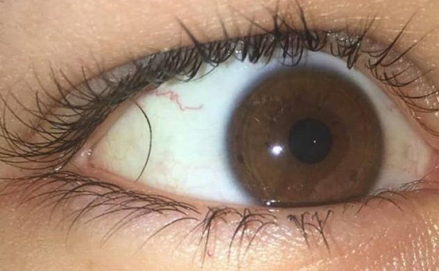 Sinir Krizi Geçirmenize Neden Olacak 6 Fotoğraf