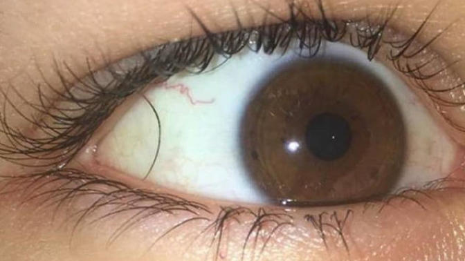 Sinir Krizi Geçirmenize Neden Olacak 6 Fotoğraf
