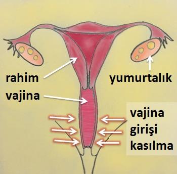 Kadınların Korkulu Rüyası Vajinismus Nedir?