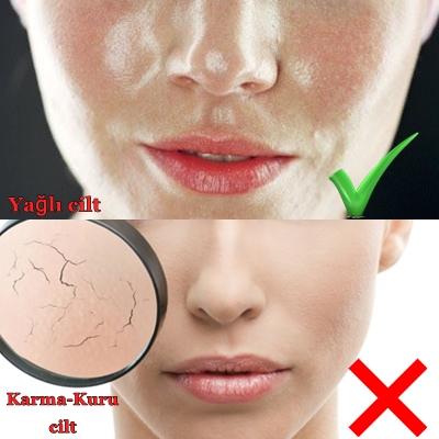 Karma-Yağlı Ciltler, Himalaya Limon-Bal Özlü Temizleyici Jelini Tercih Etmeli Mi?