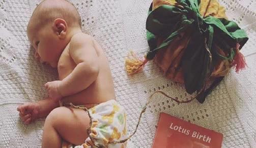 Günümüzde Yaygınlaşan Lotus Doğumu ve Bebeğe Katkısı Nedir?