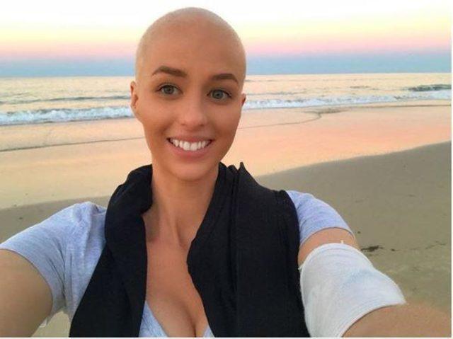 Lenfoma Kanser Hastalığına Farkındalık Yaratmak İsteyen Bir Kadın: Georgia McLennan!