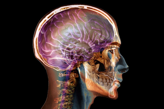 Vertigo Hastalığı Belirtileri Nelerdir?