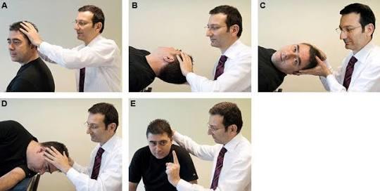 Vertigo Hastalığı Belirtileri Nelerdir?