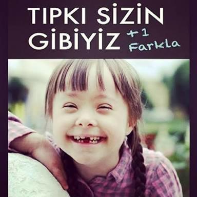 21 Mart Dünya Down Sendromu Günü, Down Sendromlu İnsanların Bizden +1 Farkı Nedir?