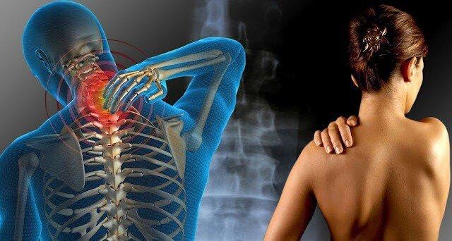 Fibromiyalji: Görünmez Hastalık
