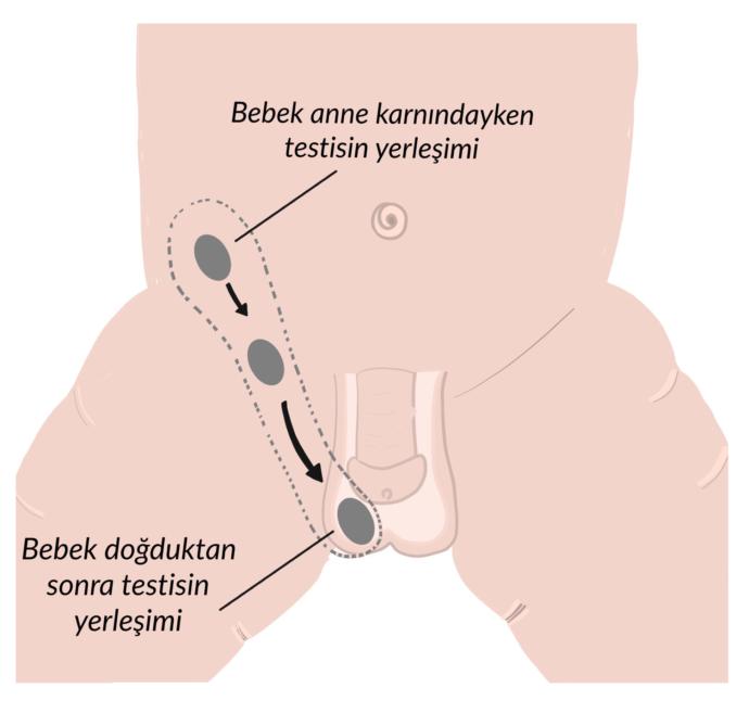 Yeni Doğan Bebekte Normal Olmayan ve Sık Görülen Durumlar