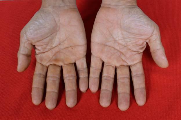 Görenlerin Ağzını Açık Bırakan Yeni ve Tuhaf Estetik Akımları