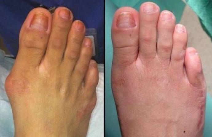 Görenlerin Ağzını Açık Bırakan Yeni ve Tuhaf Estetik Akımları