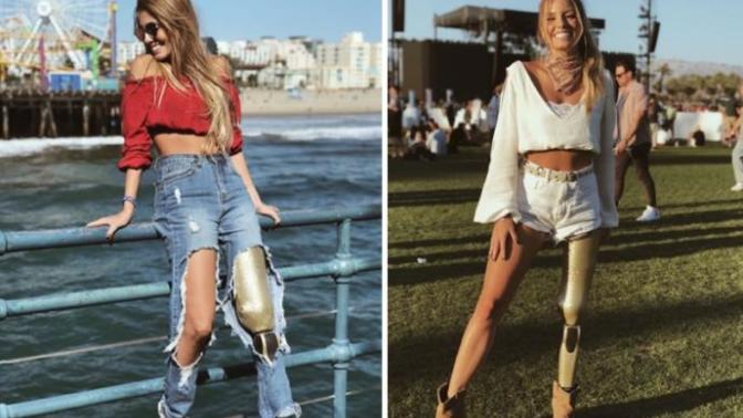 İçimizdeki Gücün İyileşmemiz İçin Yeterli Olduğunu Kanıtlayan Kadın: Paola Antonini!