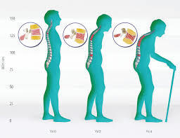 Sağlıklı Kemikler İçin Gerekli Olan 6 Vitamin!