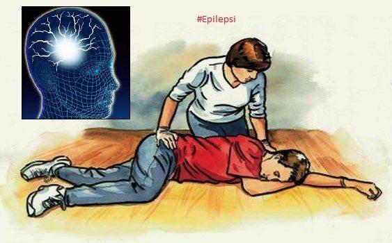 Epilepsi Hakkında Doğru Bilinen Yanlışlar Nelerdir?