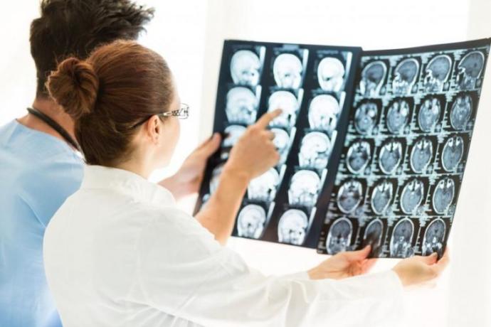 Epilepsi Hakkında Doğru Bilinen Yanlışlar Nelerdir?