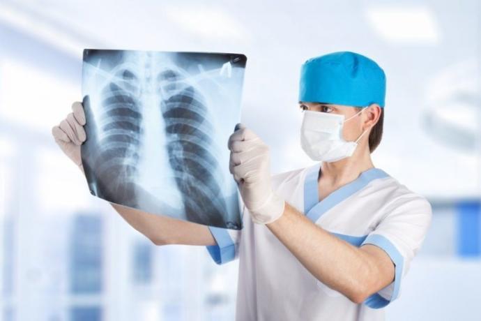 Verem Nedir? Hastalığın 8 Belirtisine Dikkat!
