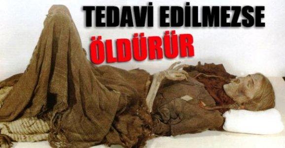Verem Nedir? Hastalığın 8 Belirtisine Dikkat!