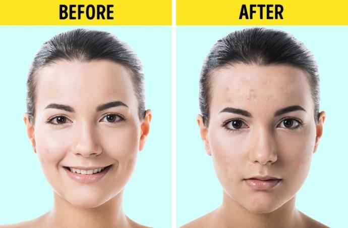 Dermatologların Kara Listesinde Yer Alan Güzellik Ürünleri!